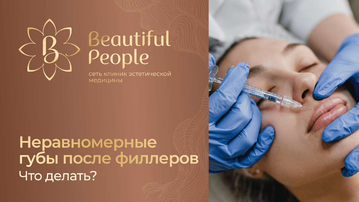 Как исправить неровные губы после процедуры филлеров?