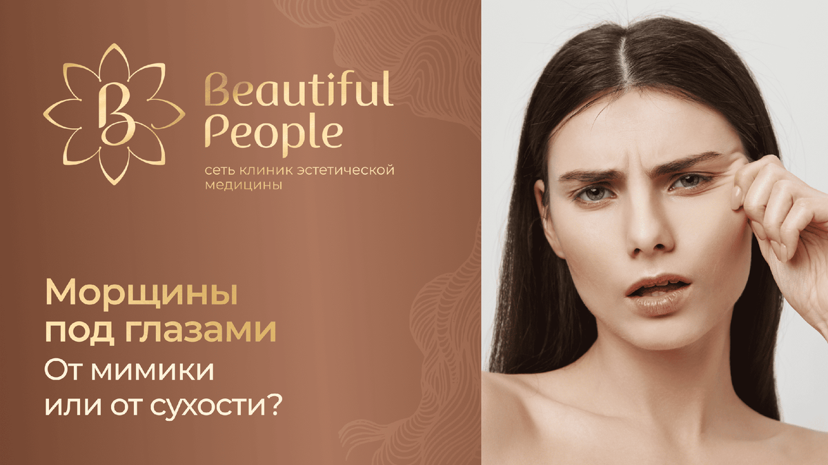 Какие бывают морщины под глазами?