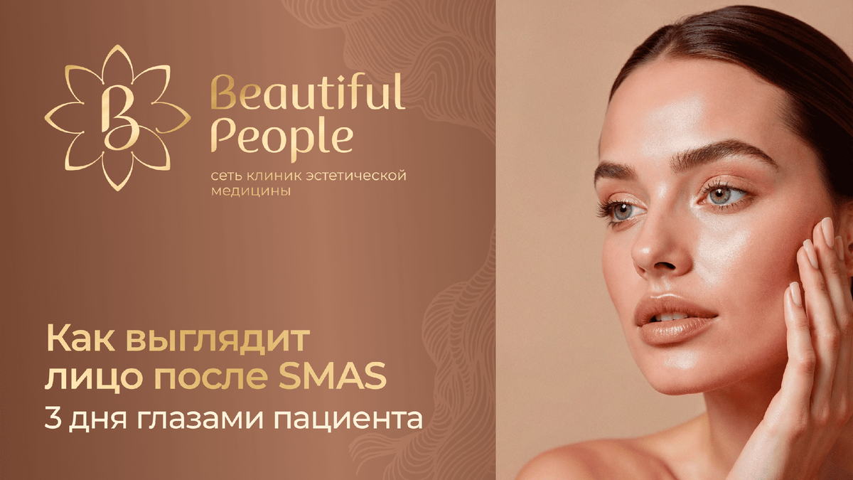 Как изменится лицо после процедуры SMAS-лифтинга