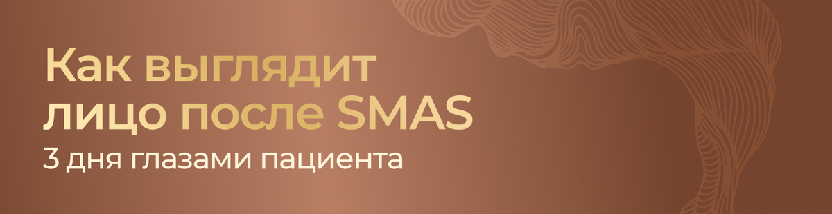 SMAS лифтинг - отзывы пациентов