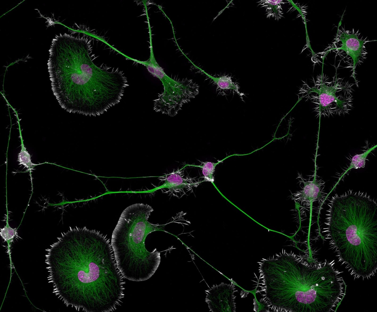 Бруно Цистерне при участии Эрика Витриола / Nikon Small World📷Дифференцированные клетки опухоли мозга мыши