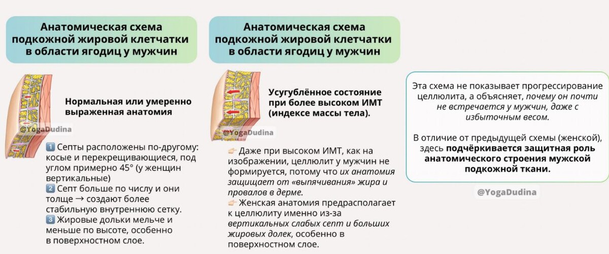 Анатомическая схема подкожной жировой клетчатки у мужчин. Фото Т. Дудиной.