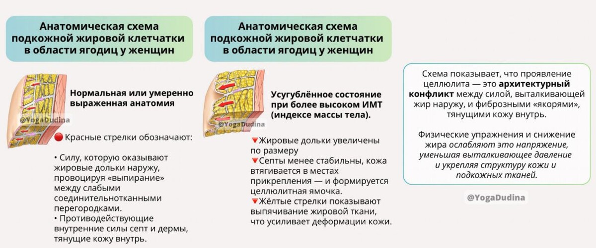 Анатомическая схема подкожной жировой клетчатки у женщин. Фото Т. Дудиной.