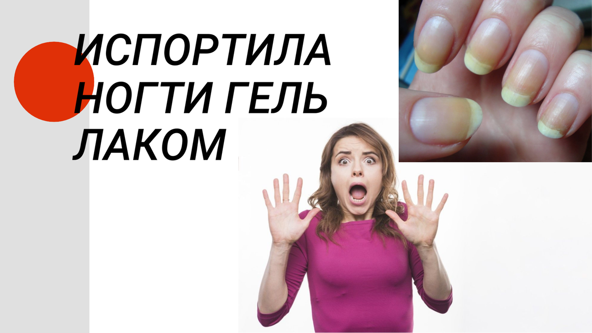 Последствия самостоятельного снятия геля