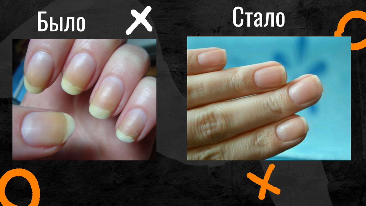 Подумайте, прежде чем самим браться за снятие гель лака