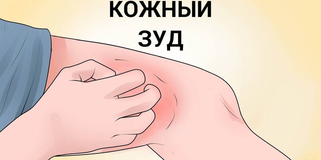 Чем Опасен Зуд Кожи у Пожилых Людей: Когда Нужно Срочно К Врачу!