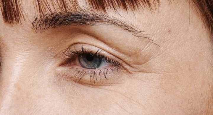 Морщины во круг глаз.