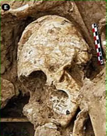 Череп молодой женщины на кладбище Тол-е Чега Софла