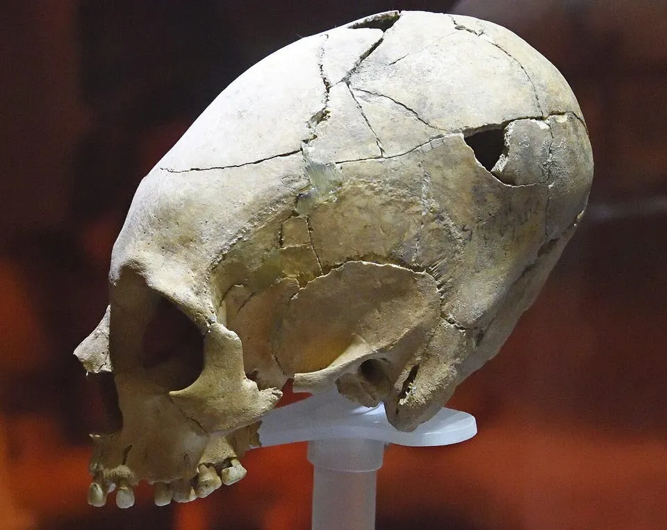 Удлинённый череп из Телль-Шей-Хююка, относящийся к периоду энеолита. В настоящее время находится в Археологическом музее Антакьи в Турции.