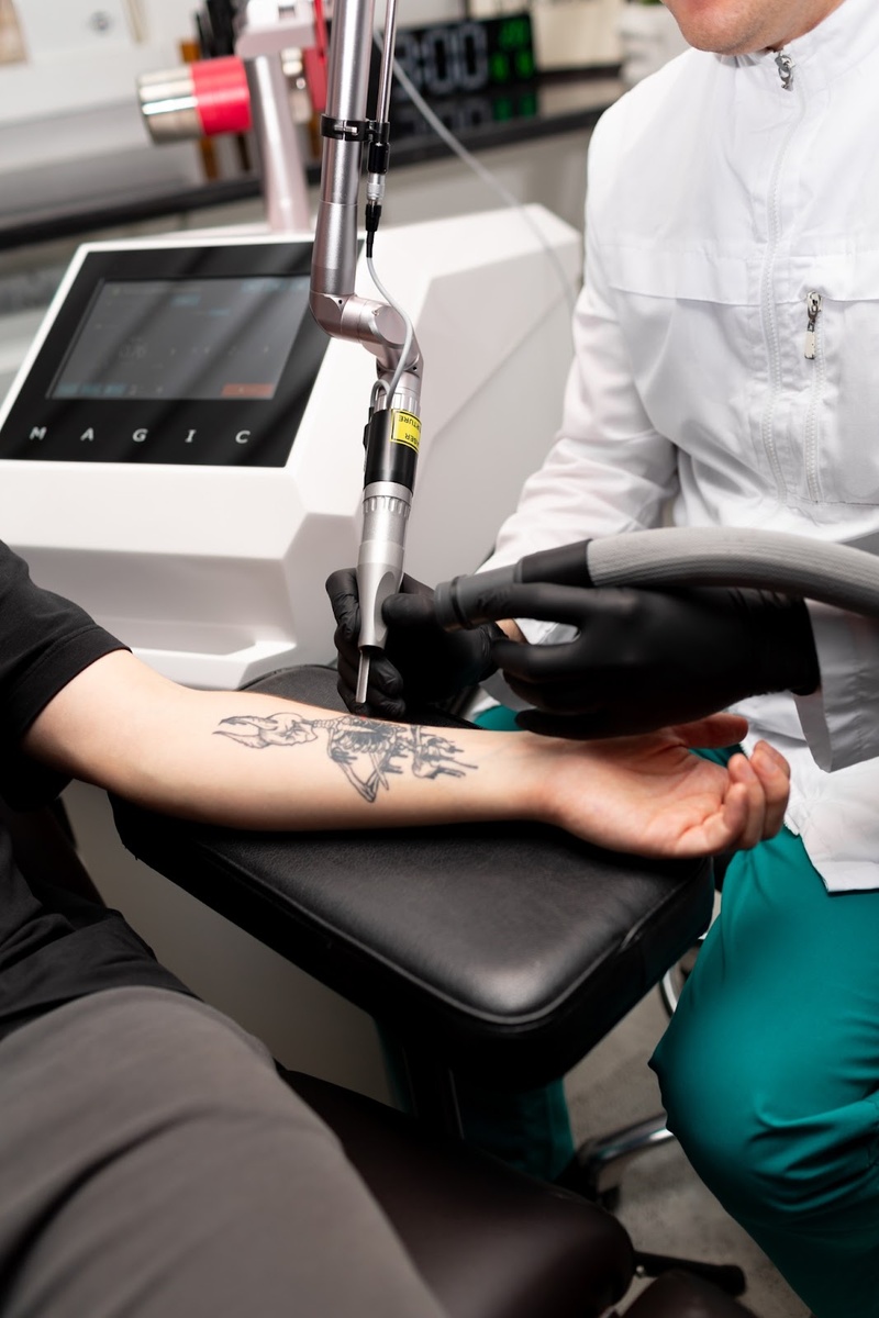 Фото: центр удаления татуировок «Дисциплина»