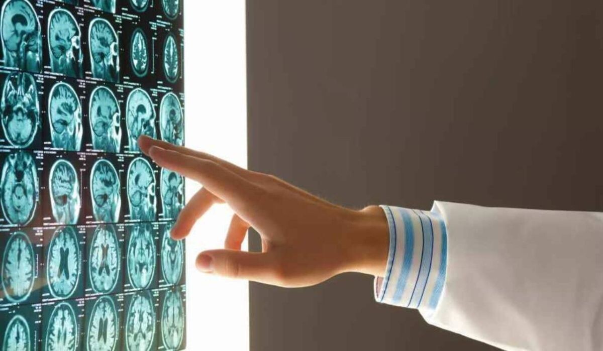     Врач смотрит снимок мозга. Источник: ria.ru Автор фото: Sergey Nivens