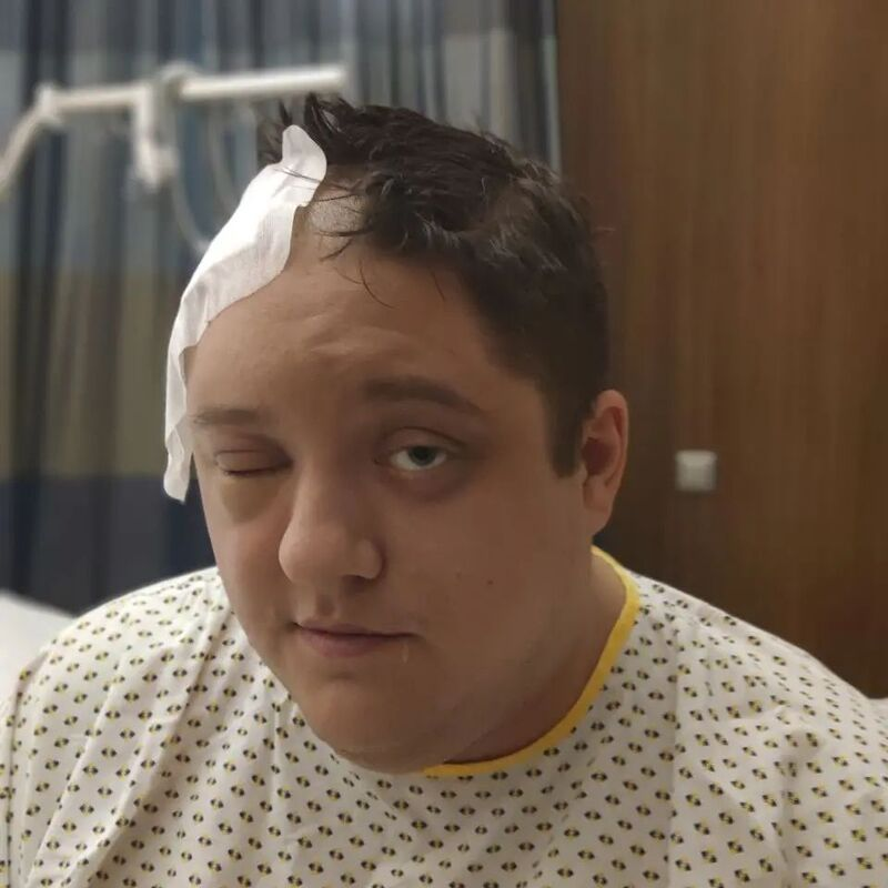 Роман Попов после операции. Фото: соцсети 