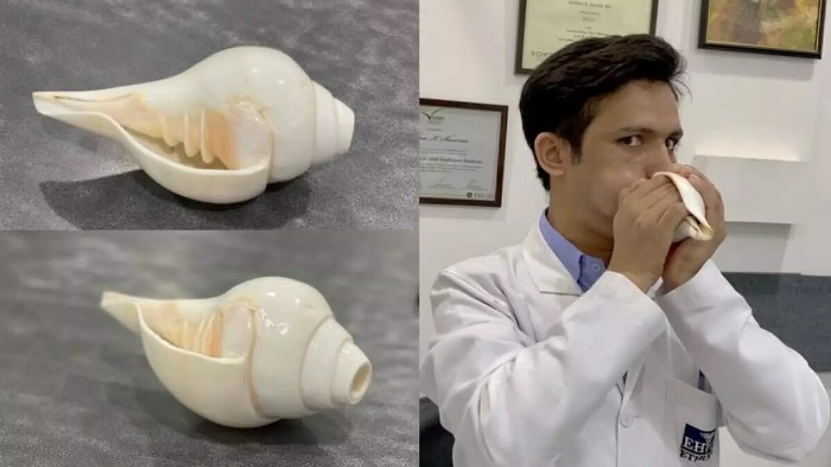 Источник: Krishna K Sharma/ERJ Open Research