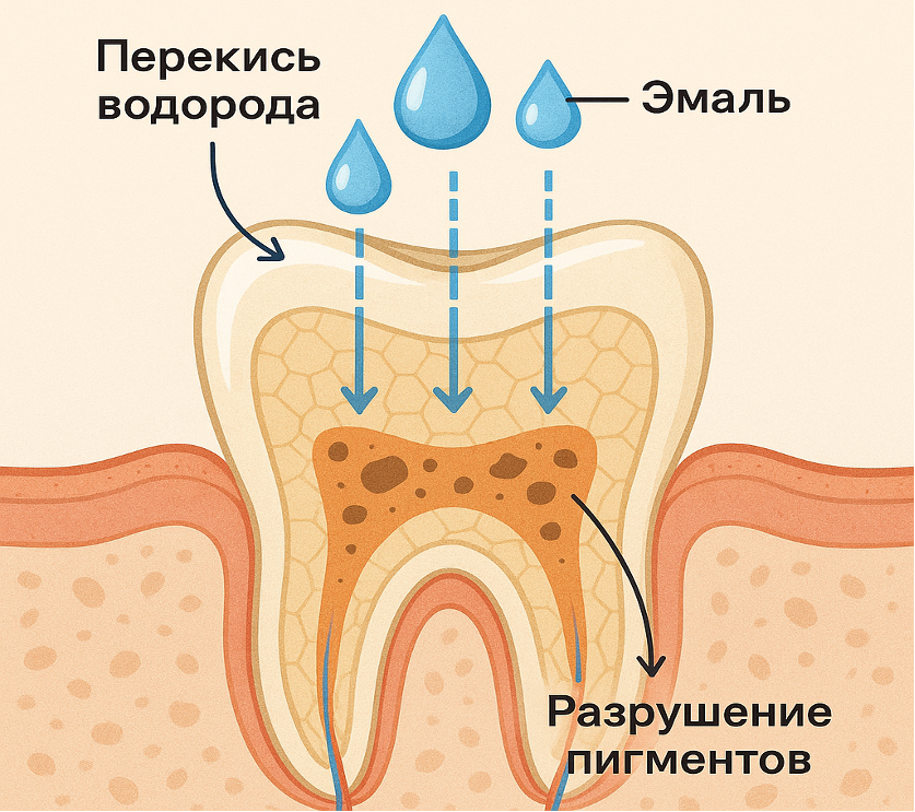Схема процесса отбеливания зубов на молекулярном уровне