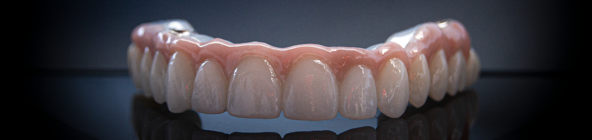 Титан-цирконий, двухсоставная конструкция с искуственной десной. Винтовая фиксация на мультиюниты.