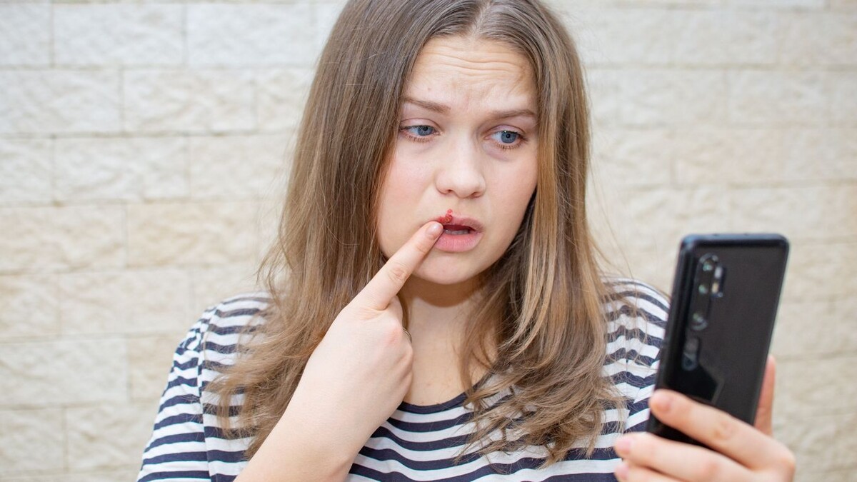 95% людей заражены, но не догадываются: врач объясняет, как вычислить герпес до высыпаний 