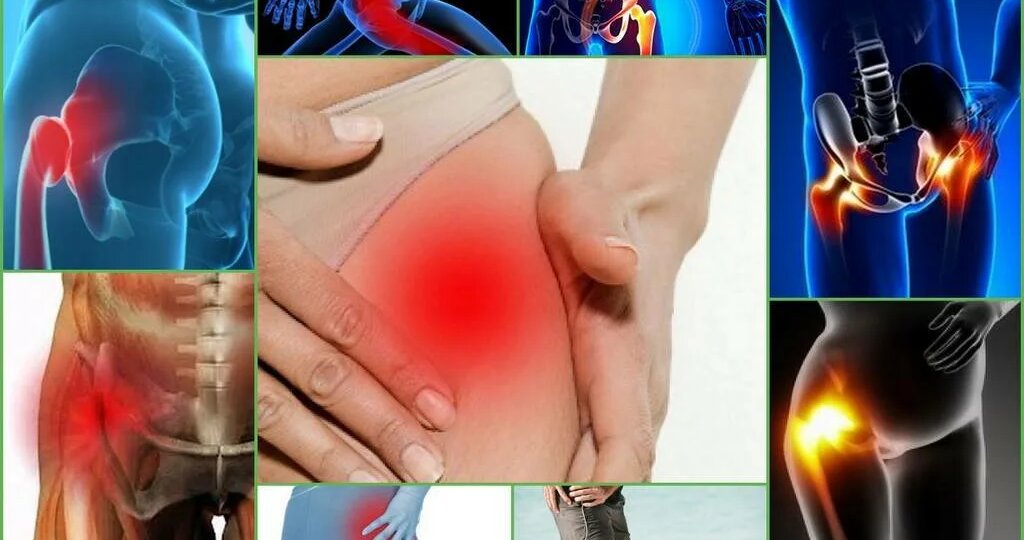 Диета при коксартрозе тазобедренного сустава