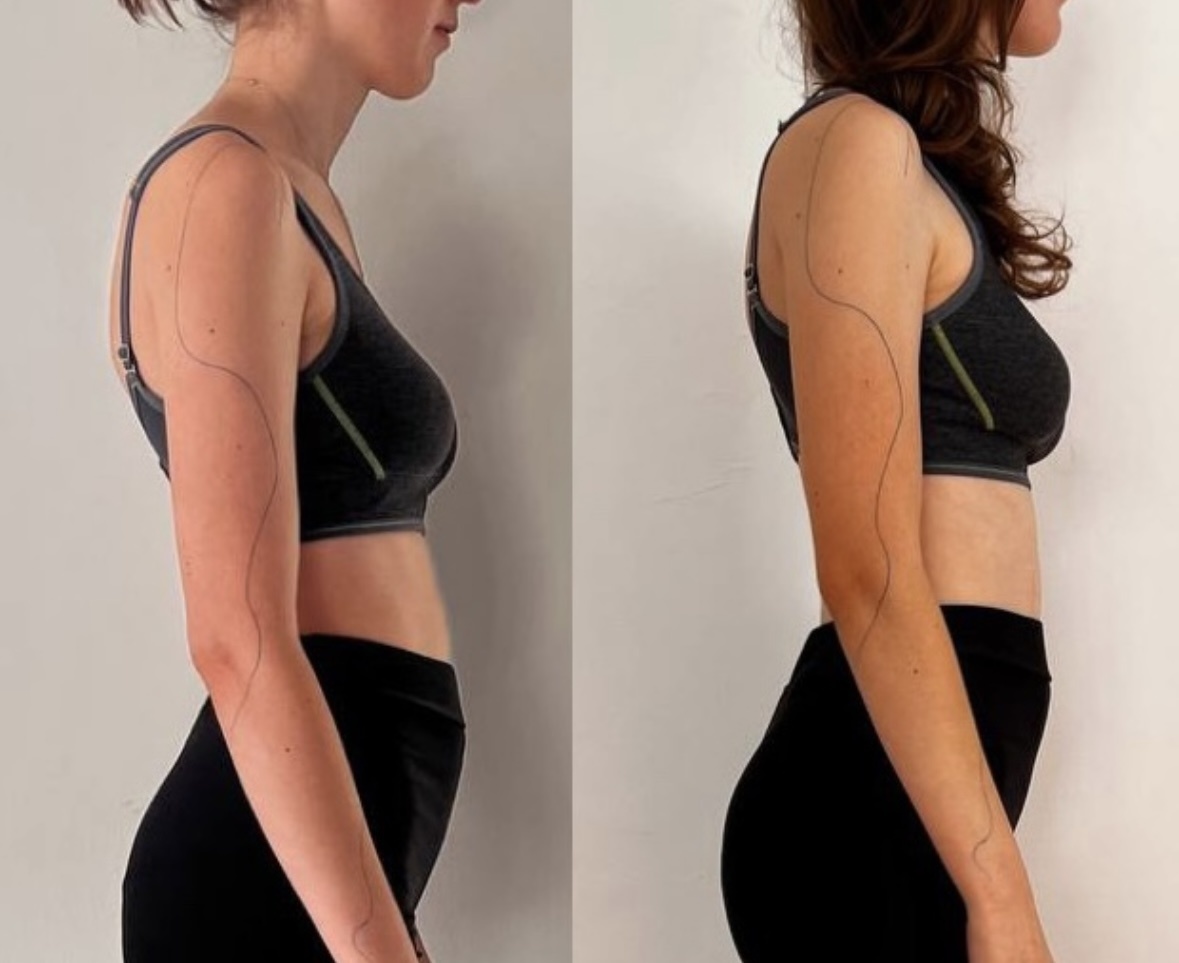 Пример из личной практики 