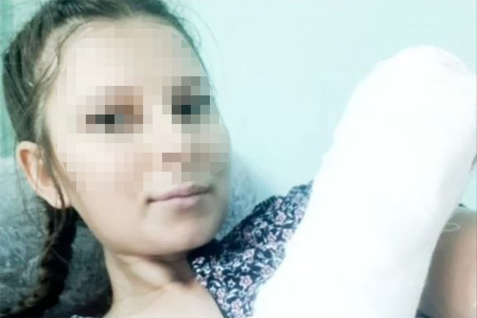 Фото Анастасии после происшестия опубликовано «КП-Кубань» из архива героини публикации