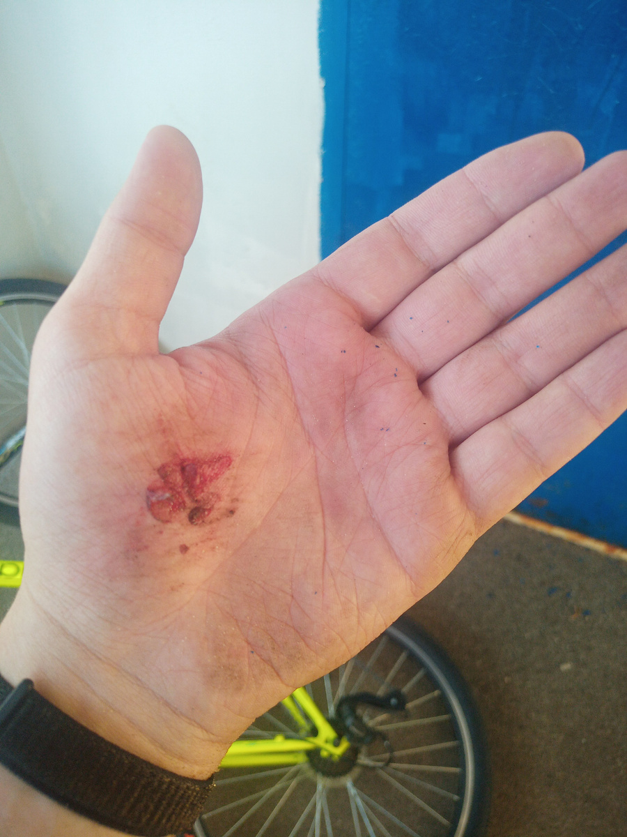 Последствия падения