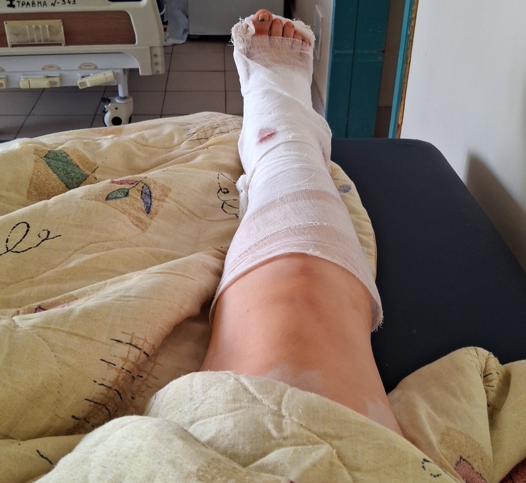 Лежу красиво с гипсом после остеосинтеза. https://dzen.ru/woodduck