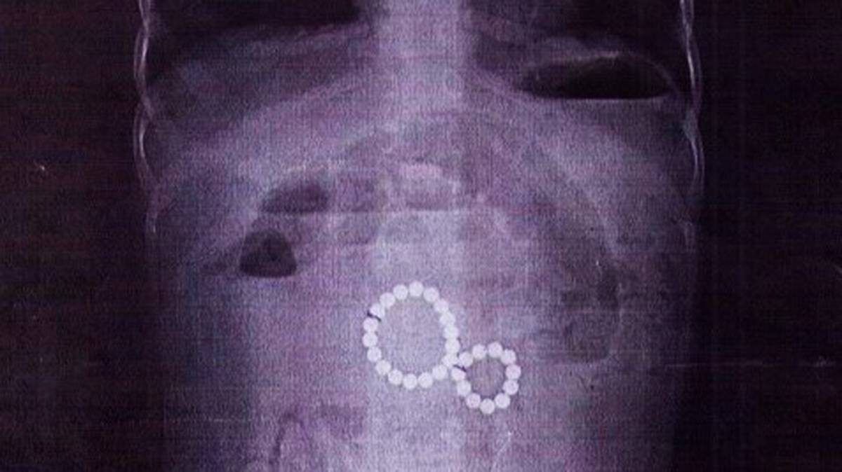    Фото: ВКонтакте / Детская областная больница Иркутск