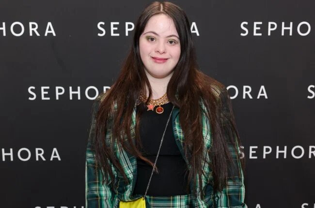 Фото: downs-syndrome.org uk