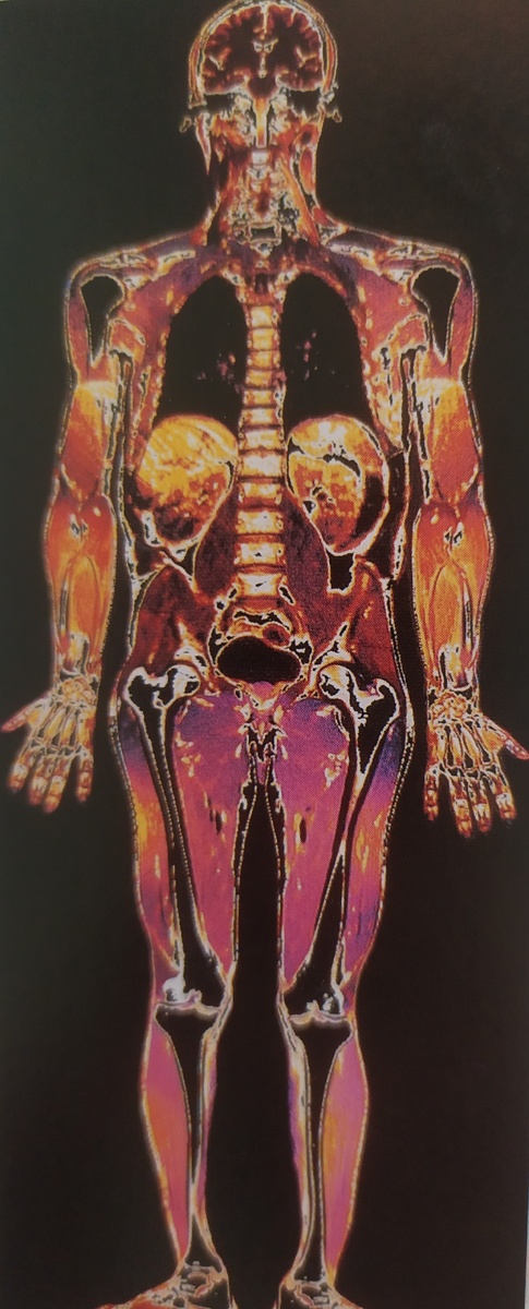Это детельное изображение костей и мягких тканей получено с помощью ЯМР-томографии