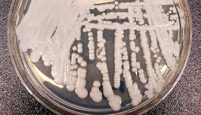 Candida auris в чашке Петри. Фото: Shawn Lockhart, wikipedia.org (общественное достояние)
