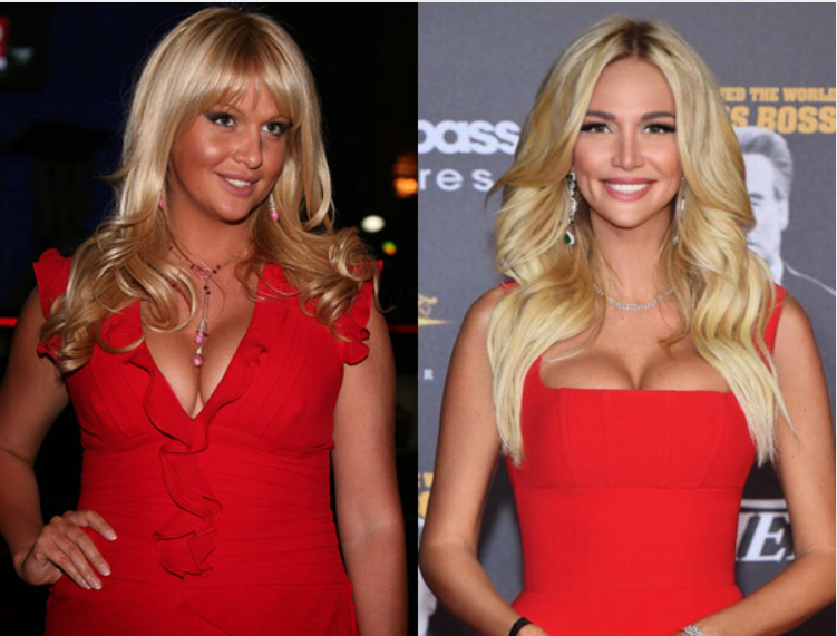 Что общего у этих женщин? Верно. Ничего. 