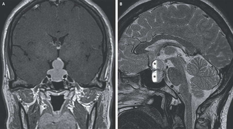   Yuwei Zhou, Wei Weng / NEJM, 2025