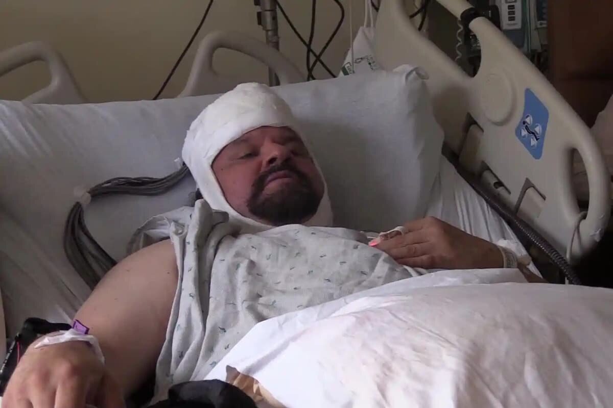    Первый этап эксперимента: исследователи имплантировали пациенту электроды в 14 различных участков головного мозга, чтобы определить локализацию сигналов, связанных с болью / © University of California, San Francisco