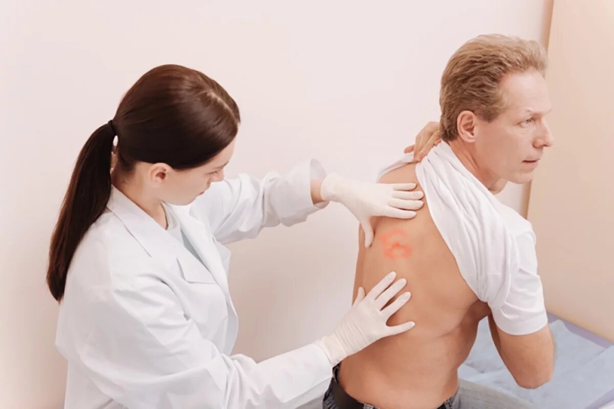    Заразные пятна.