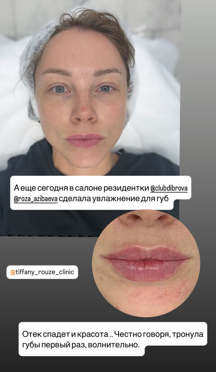 Листайте вправо, чтобы увидеть больше изображений