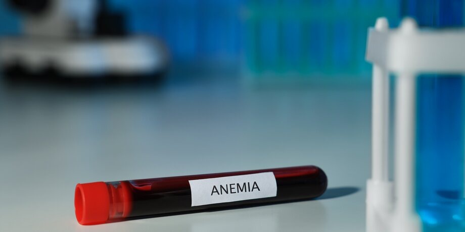 Фото: 123RF/liudmilachernetska