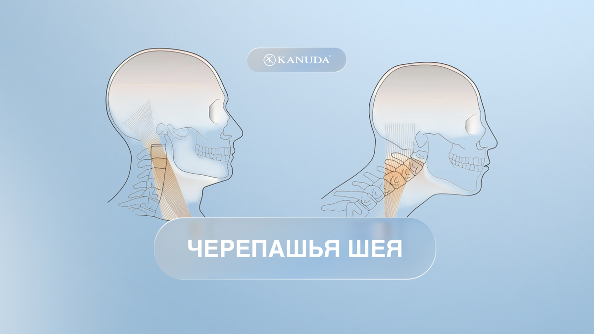 Черепашья шея 