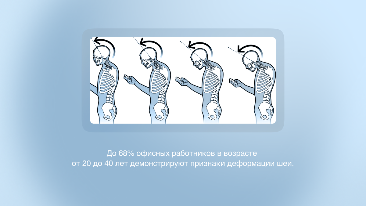 Офисные работники подвергаются чаще