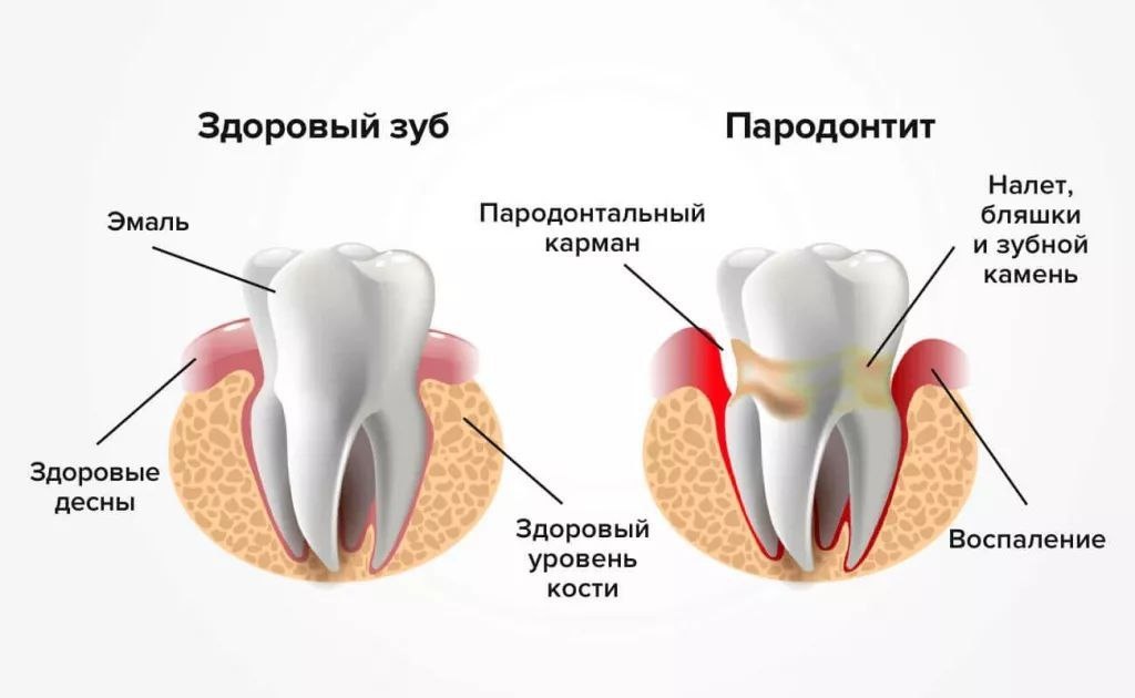 Данное фото взято из сети интернет. 