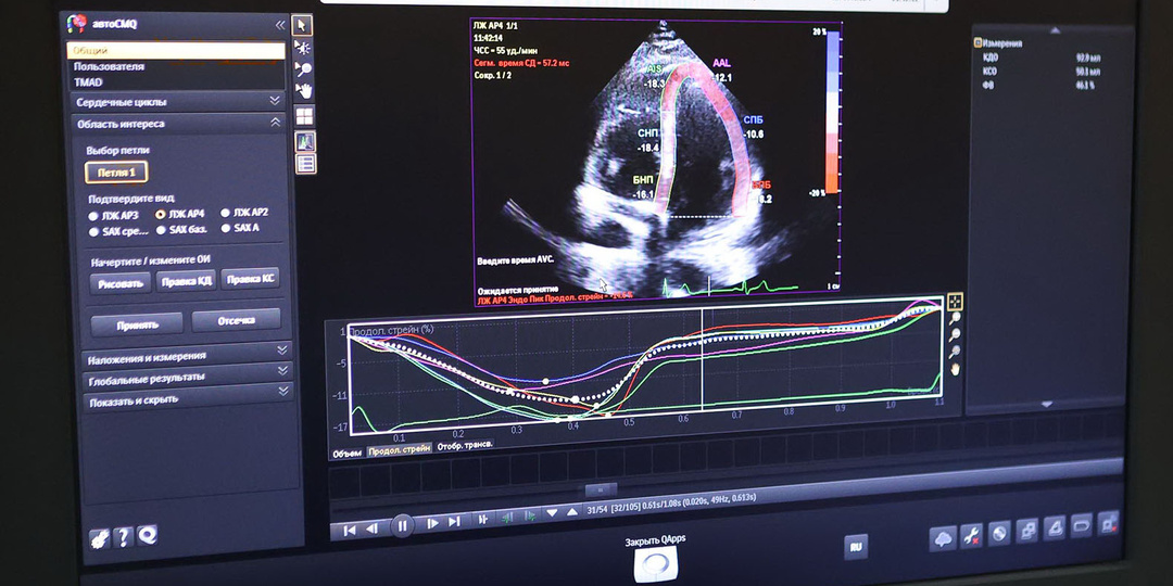 Откуда берётся атеросклероз и можно ли почистить сосуды. Рассказывает кардиолог