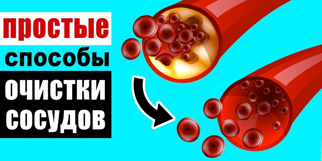 3 простых привычки, которые очищают сосуды от бляшек