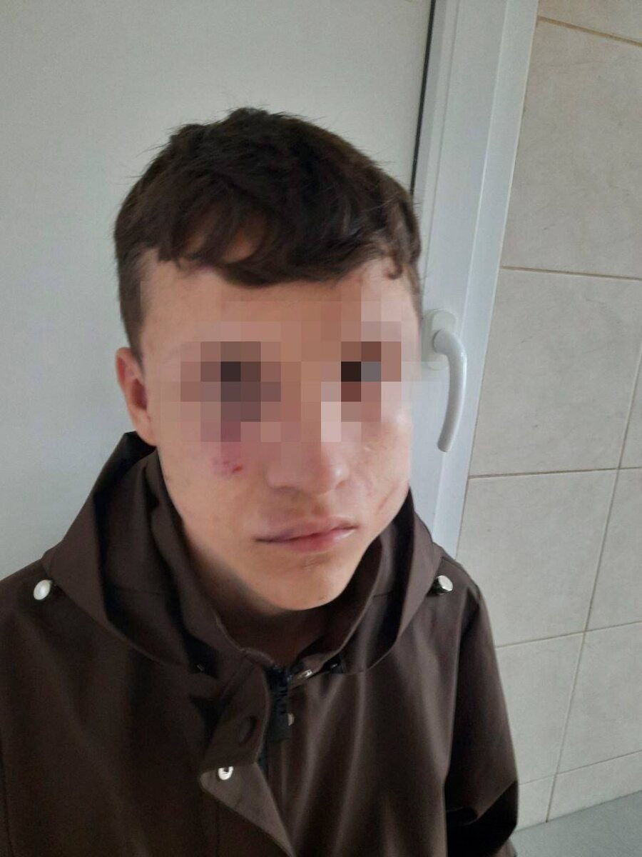 Последствия избиения. Фото: соцсети