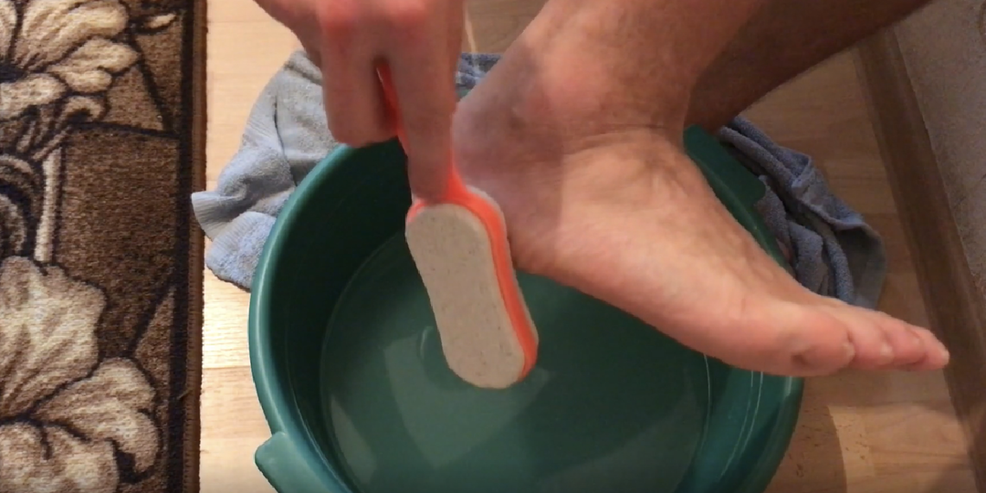 Как я избавляюсь от натоптышей с помощью "Аммиака" и кефира