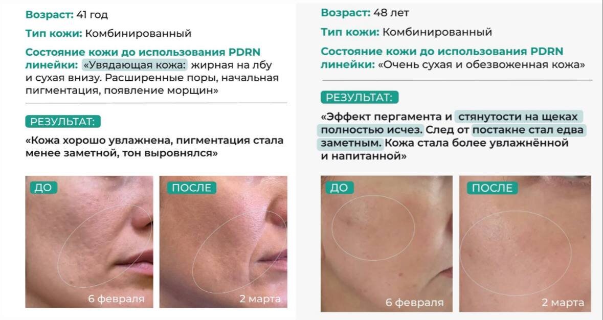 Результаты до/после тестирования фокус группы линейки PDRN от VT Cosmetics. Участницы использовани 4 средства на протяжении нескольких недель: "PDRN Glow Ampoule", "PDRN R5 Firming Ampoule", "PDRN Essence 100" и "PDRN Essence Stick Balm". Именно этим средствам посвящена данная статью, советую ознакомиться!