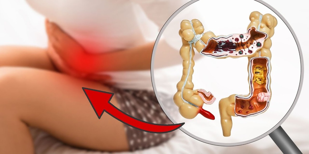 4 признака, что кишечник работает неправильно