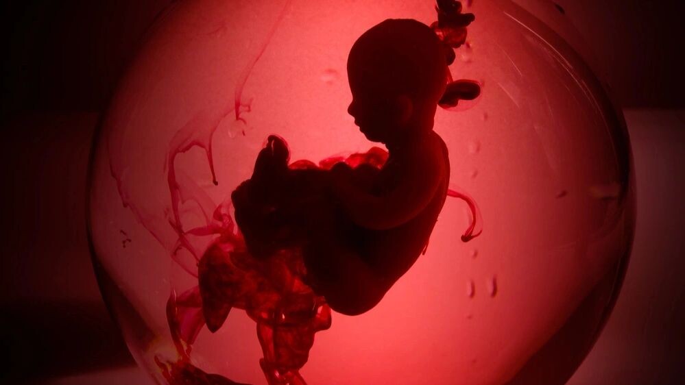    Фото: vetre/Shutterstock/Fotodom