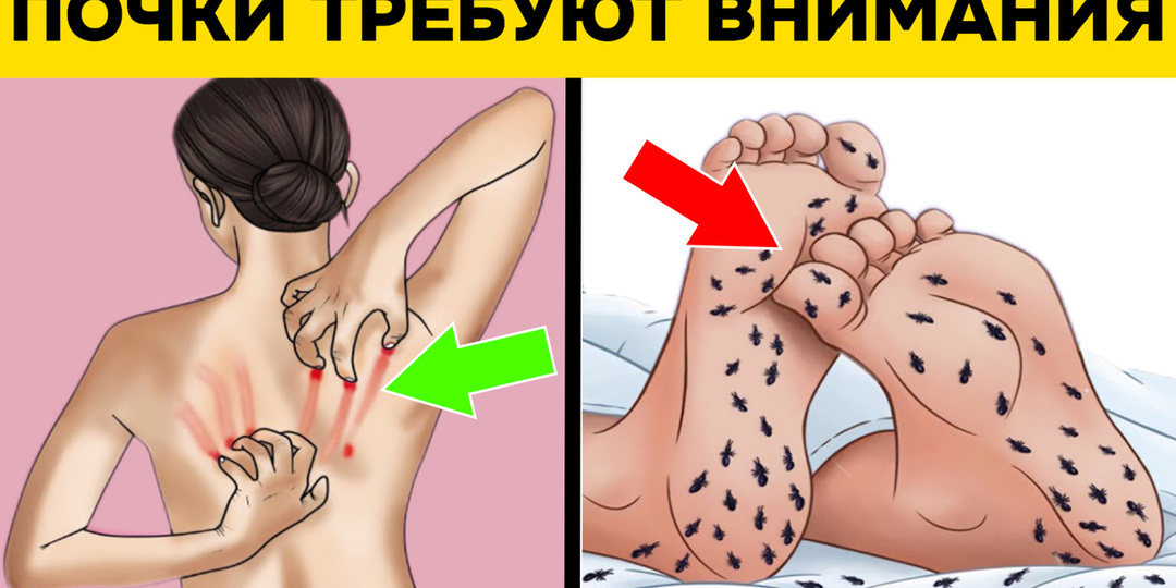 8 тревожных признаков, которые могут свидетельствовать о том, что ваши почки нуждаются в особом внимании и уходе