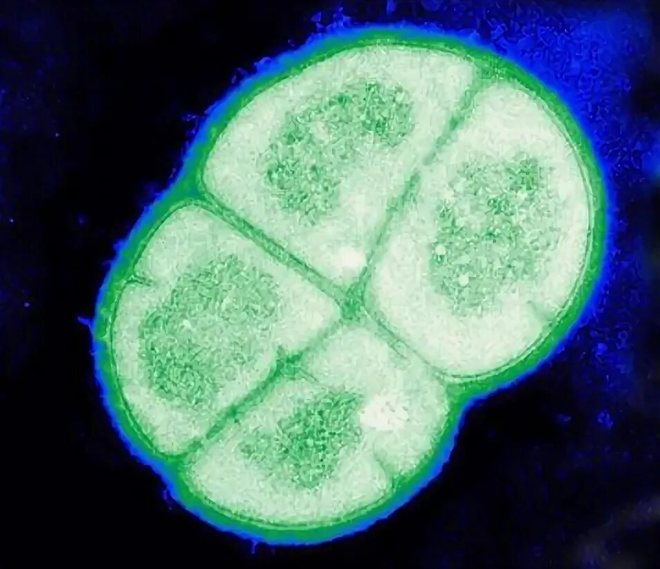 Deinococcus radiodurans