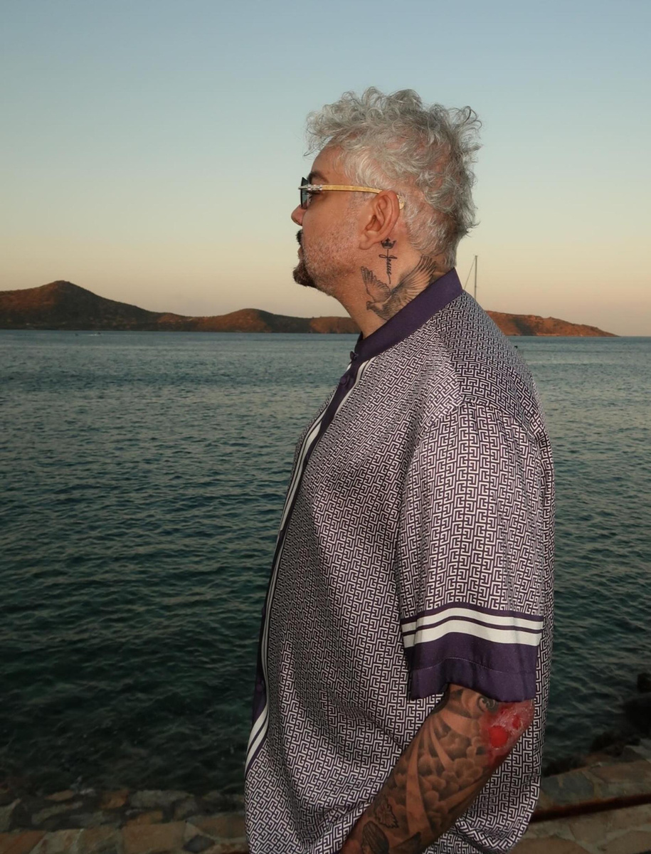    Ожог Киркорова. Инстаграм (запрещён в РФ) @fkirkorov