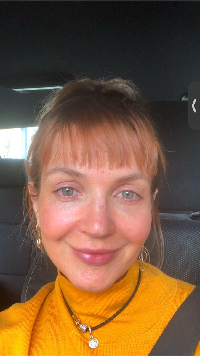 Вот результат без воды и косметики на 7 день, видны участки загрязнения, но кожа в целом неплохо заработала.