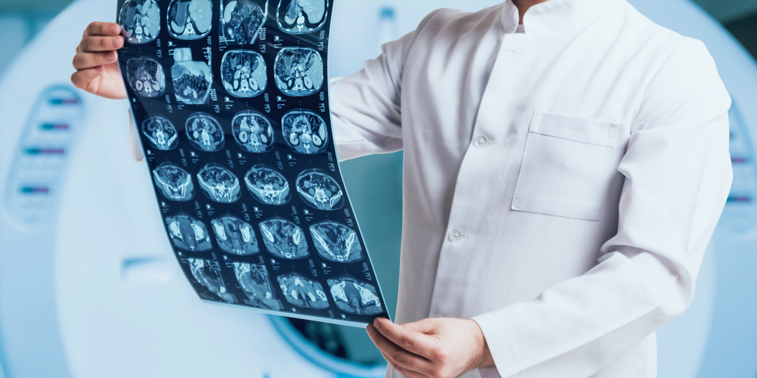 Читать заключение МРТ самостоятельно опасно?